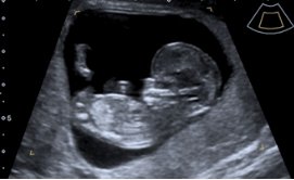 "Just a quick update on my pregnancy!" - Conceive Plus® UK
