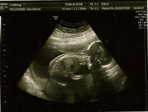 baby ultrasound