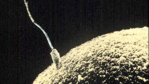 Lab Grown Sperm Could Cure Male Infertility - Conceive Plus® UK